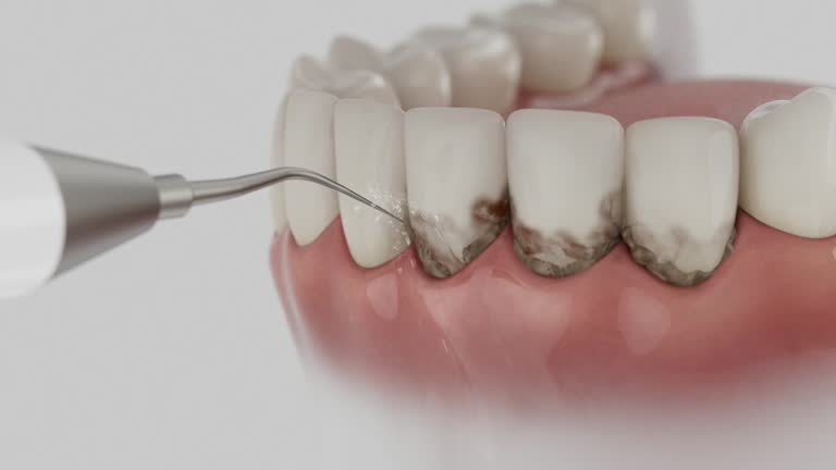Reliable Emergency Dentist contractor in Charlack, MO by Smile Center Dentistry